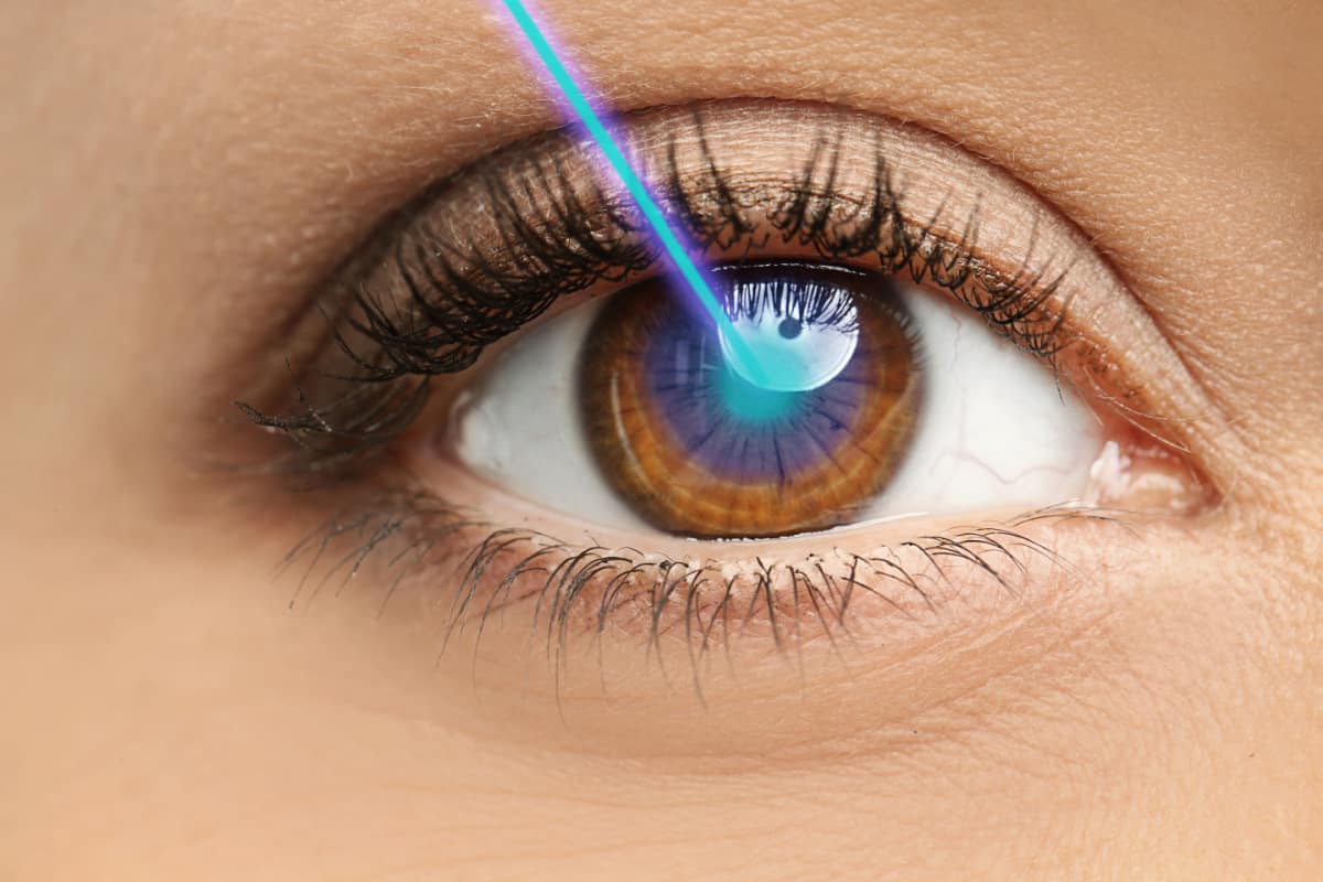 laser eye surgery Miami